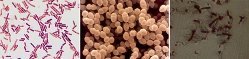 E. coli, fecal enterococcus and proteus are the leading causative agents of chronic bacterial prostatitis