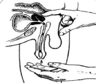 Massage the prostate for secretions