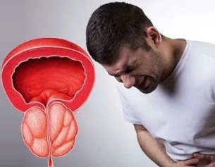 The symptoms of prostatitis, chronic in a male
