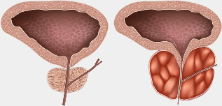 the healthy and diseased breast